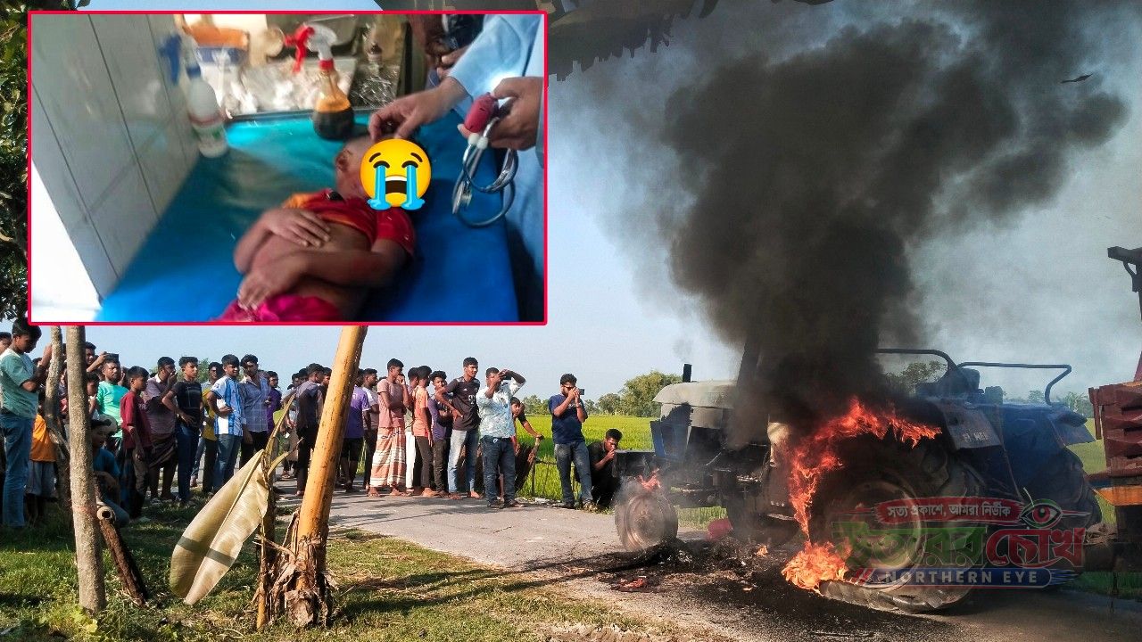 খানসামায় ট্রলির চাকায় পিষ্ট হয়ে ৪ বছরের শিশুর মৃত্যু, ক্ষুব্ধ জনতার আগুন